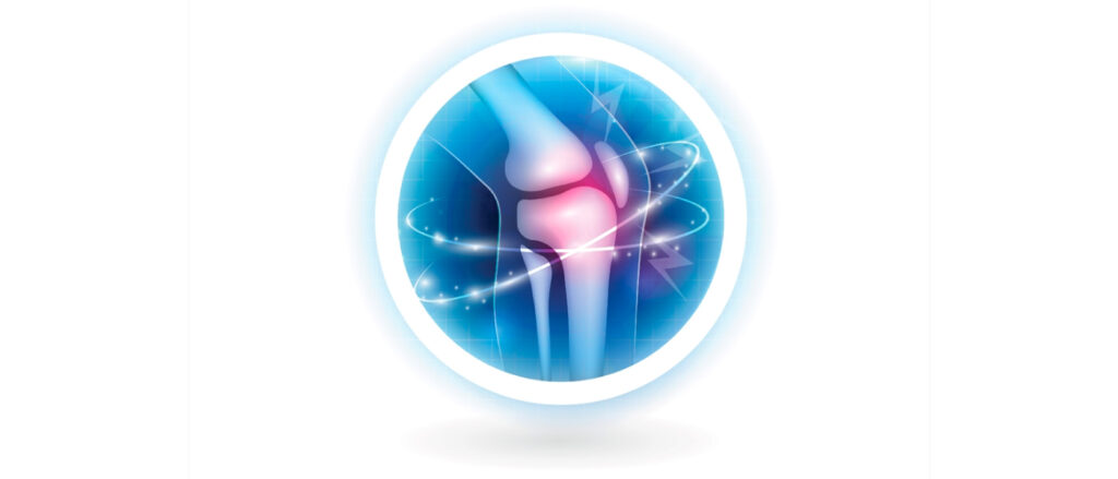 Graphic of a knee x-ray