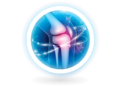 Graphic of a knee x-ray
